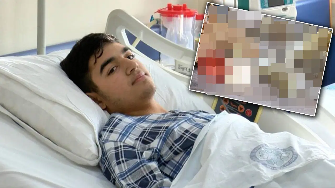 'Çiğ' şekilde yedi, karaciğeri iflas etti