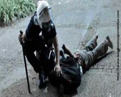Polisin kör ettiği gence hapis cezası, polis serbest
