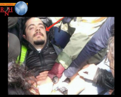 Bu gün 3 Mayıs günler geçiyor, 1 Mayıs'ta bıçaklanan Özgür Altunbilek'e polis baskısını hatırlatalım